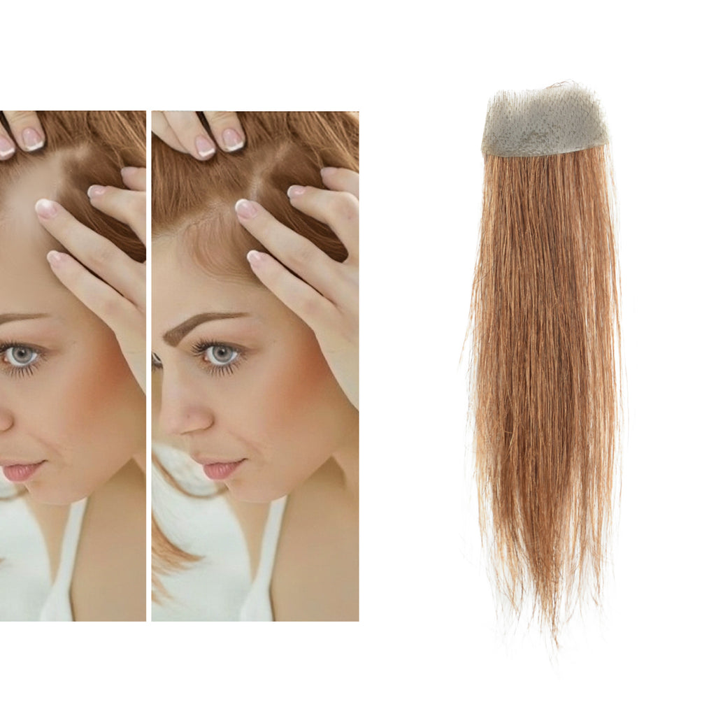 viviaBella human hair bald spot hair patch toupee scar human hair replacement hairline loss straight Tape for men and women