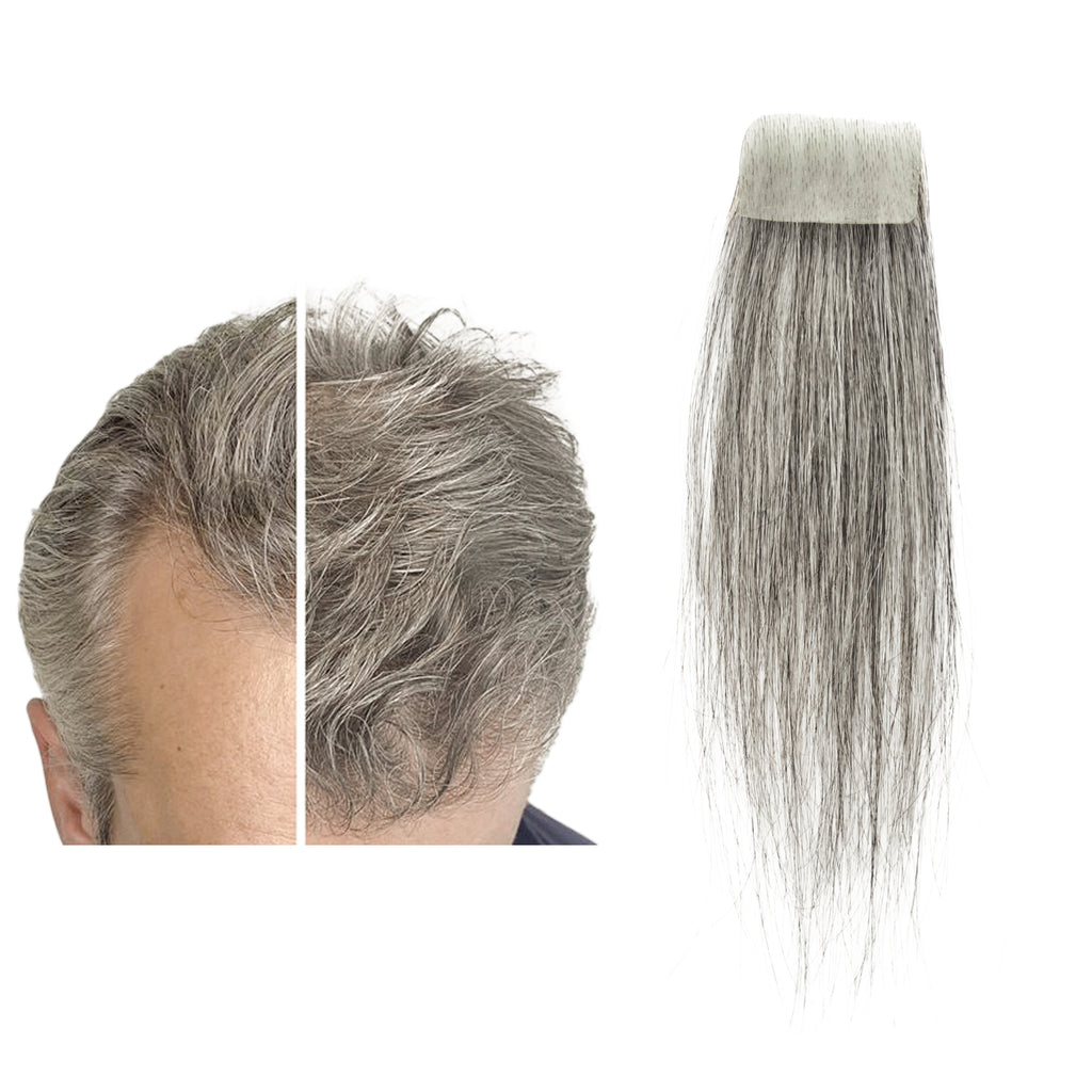 viviaBella human hair bald spot hair patch toupee scar human hair replacement hairline loss straight Tape for men and women