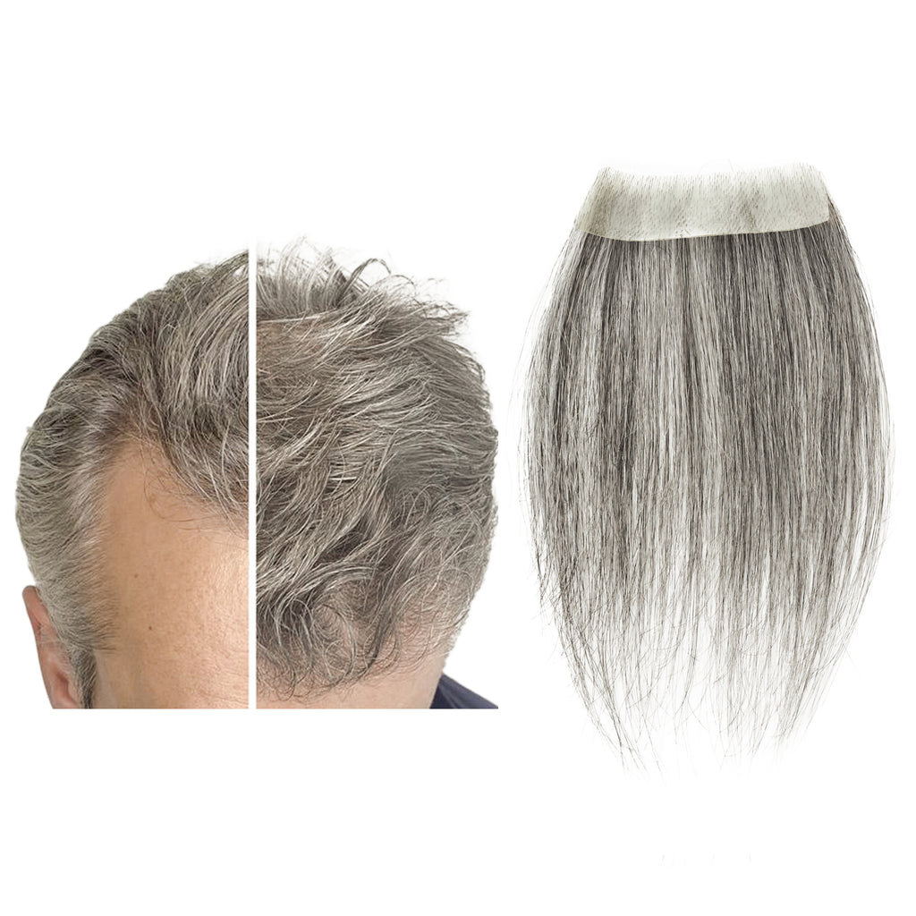viviaBella human hair bald spot hair patch toupee scar human hair replacement hairline loss straight Tape for men and women