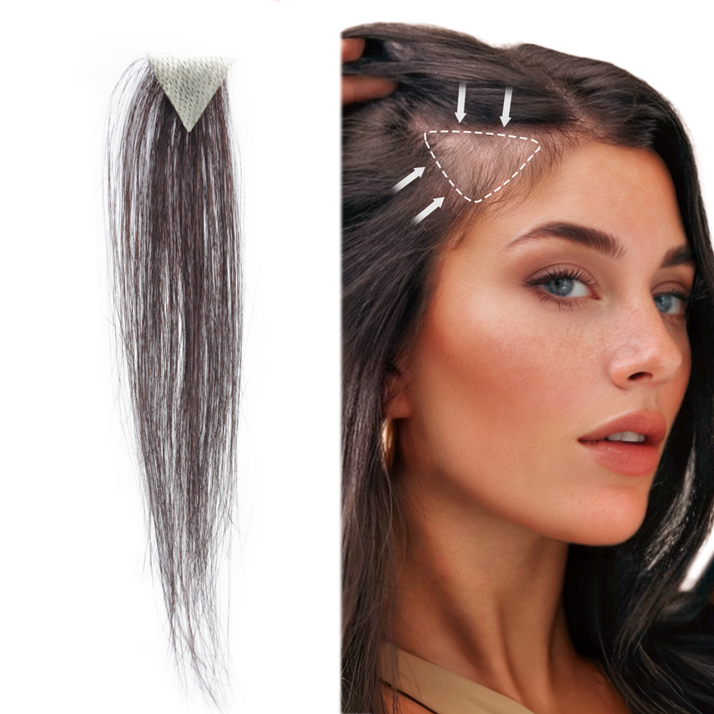 viviaBella human hair hairloss on temples bald spot toupee scar human hair replacement hairline straight Tape-on Triangle hair patch for men and women（2Pcs）