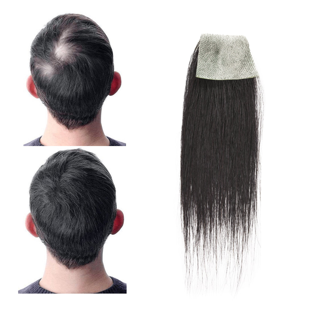 viviaBella human hair bald spot hair patch toupee scar human hair replacement hairline loss straight Tape for men and women