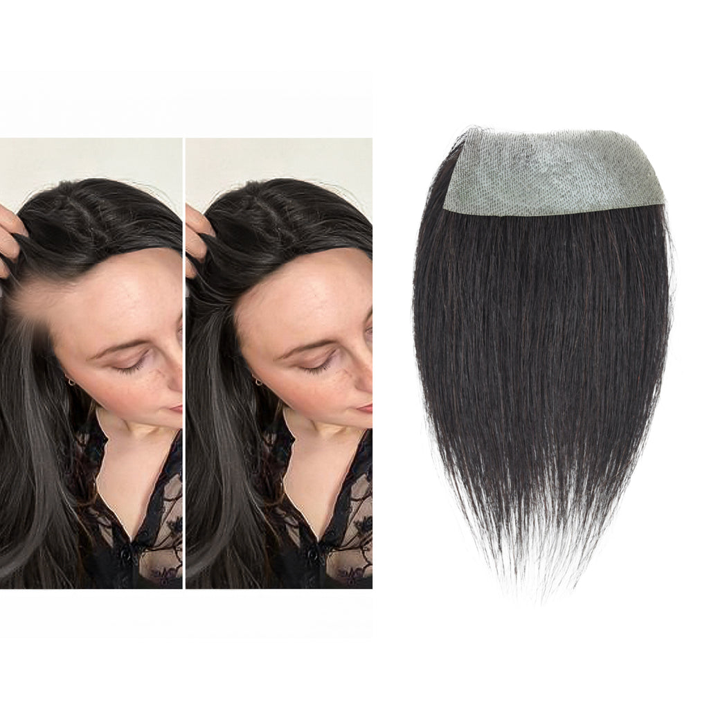 viviaBella human hair bald spot hair patch toupee scar human hair replacement hairline loss straight Tape for men and women