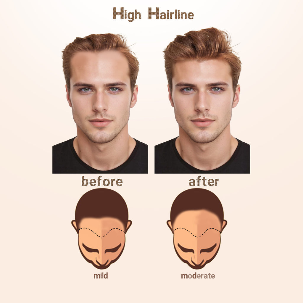 viviabella Frontal Hairpiece for men Natural Black Hair Extension Hairline Loss Straight Tape in Human Hair Toppers Replacement Toupee